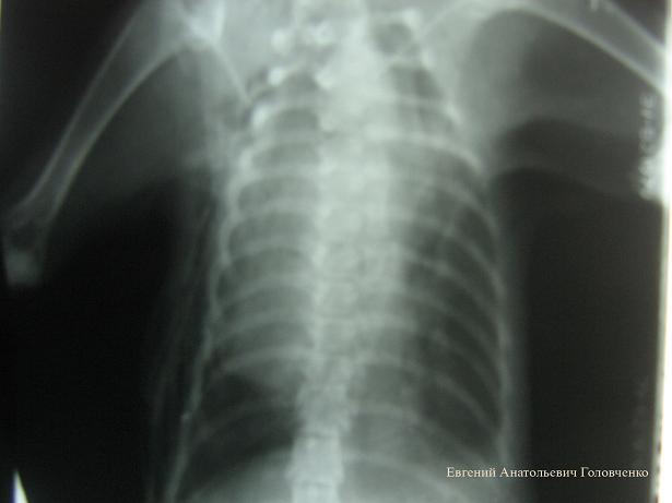Воронкообразная грудная клетка у котенка. Воронкообразная грудная клетка степени по рентгену. УЗИ грудной клетки у животных. У каких животных нет грудной клетки-.